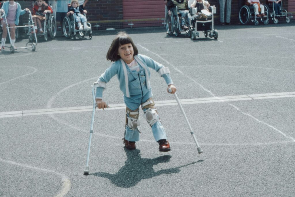 JMJ Disability news - little girl with crutches